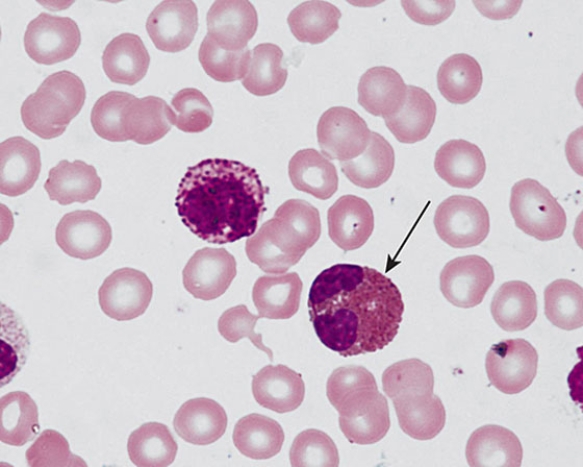 The cell at the tip of the pointer   A)  phagocytoses bacteria B)  phagocytoses antigens C)  releases major basic protein D)  releases eosinophil chemotactic factor E)  binds IgE to its plasmalemma