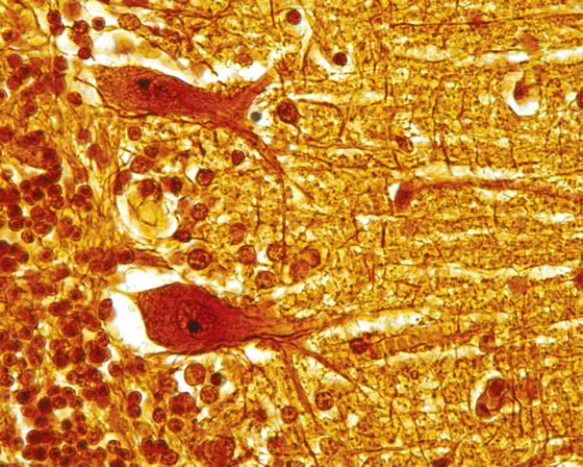In Fig. Img_003, a patient who has a stroke involving this region of the central nervous system has damage to her   A)  cerebrum B)  cerebellum C)  spinal cord D)  thalamus E)  hypothalamus