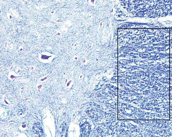 The region within the rectangle is the   A)  cerebellar cortex B)  cerebellar medulla C)  gray matter of the spinal cord D)  white matter of the spinal cord E)  cerebral cortex