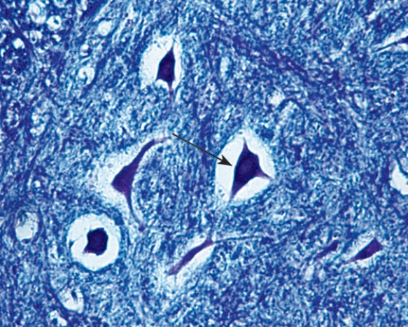 Identify the cell at the tip of the arrow   A)  unipolar neuron B)  pseudounipolar neuron C)  bipolar neuron D)  interneuron E)  multipolar neuron