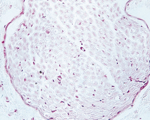 Identify the structure   A)  dorsal root ganglion B)  nerve fiber C)  adipose tissue D)  autonomic ganglion E)  embryonic connective tissue