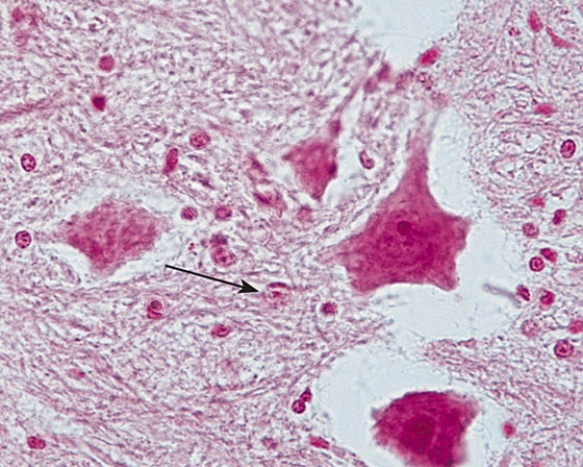 Identify the cell at the tip of the arrow   A)  unipolar neuron B) pseudounipolar neuron C)  bipolar neuron D)  interneuron E)  astrocyte