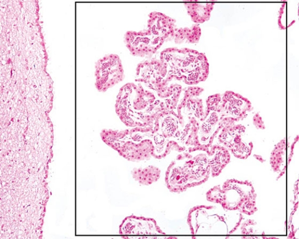 The structure located in the rectangle is responsible for the   A)  formation of cerebrospinal fluid B)  elimination of cerebrospinal fluid C)  lining of the ventricles of the brain D)  lining the central canal of the spinal cord E)  formation of new neurons