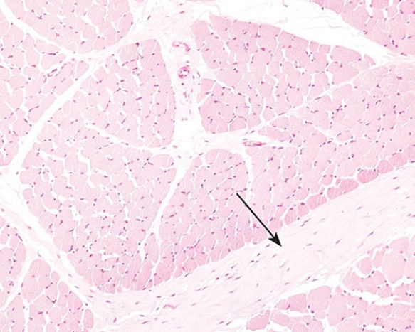 Identify the structure (clear area)  at the tip of the arrow   A)  epineurium B)  perineurium C)  endomysium D)  perimysium E)  epimysium