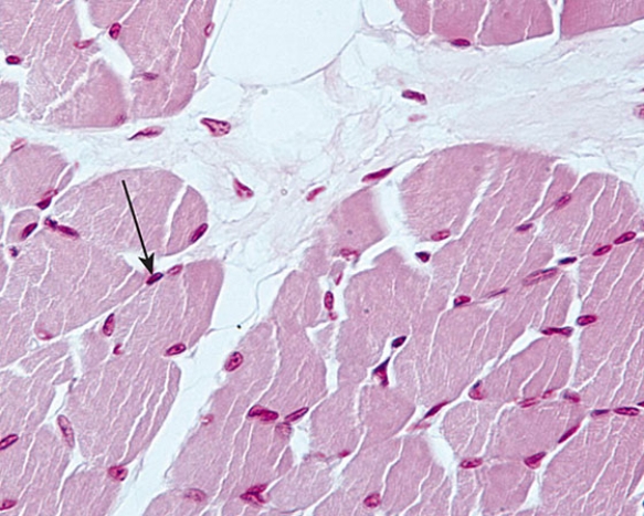 Identify the cell whose nucleus is at the tip of the arrow   A)  skeletal muscle cell B)  adipocyte C)  satellite cell D)  Schwann cell E)  endothelial cell