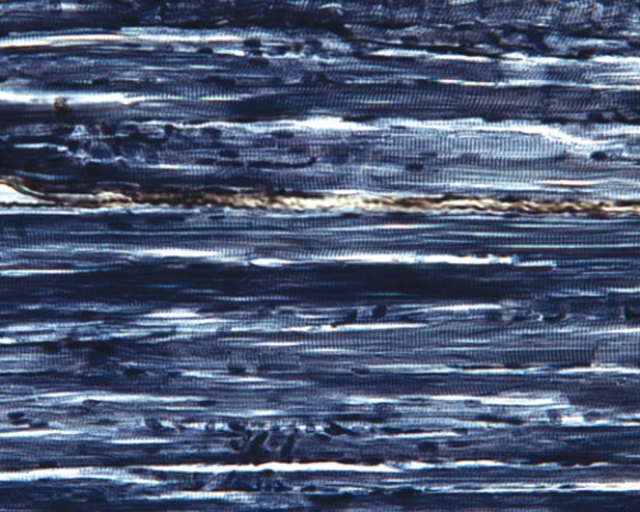 Identify this tissue   A)  cardiac muscle B)  dense regular elastic connective tissue C)  dense regular collagenous connective tissue D)  skeletal muscle E)  elastic cartilage