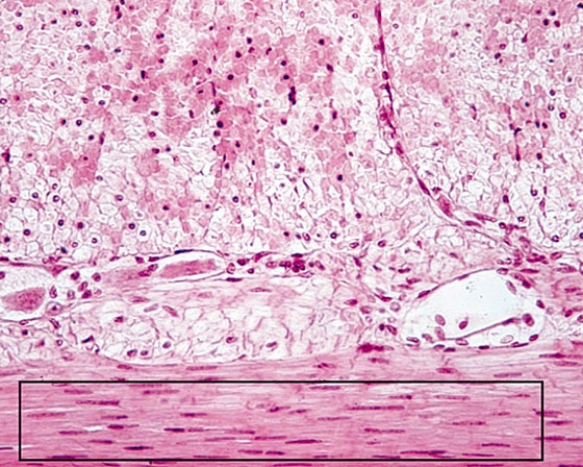 Identify the tissue within the rectangle   A)  dense regular collagenous connective tissue B)  dense regular elastic connective tissue C)  skeletal muscle D)  cardiac muscle E)  smooth muscle