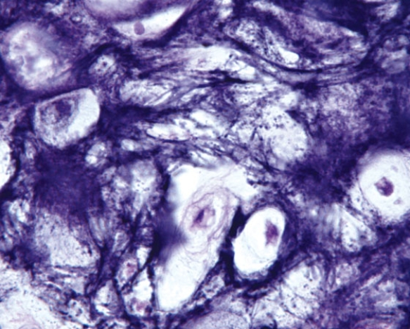 In Fig. Img_011, a patient presents with a nodule in his oral cavity/oral pharynx. The photomicrograph shows the normal area of his biopsy. The structure housing the nodule is the   A)  uvula B)  hard palate C)  soft palate D)  epiglottis E)  palatine tonsil