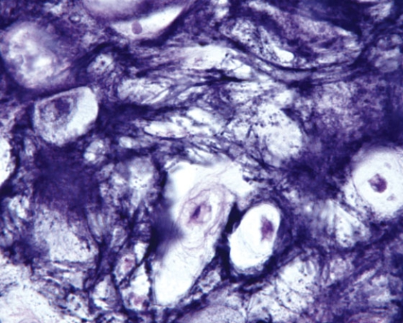 In Fig. Img_011a, the predominant fiber types in this light micrograph are elastic fibers and   A)  type I collagen B)  type II collagen C)  type III collagen D)  type IV collagen E)  type V collagen