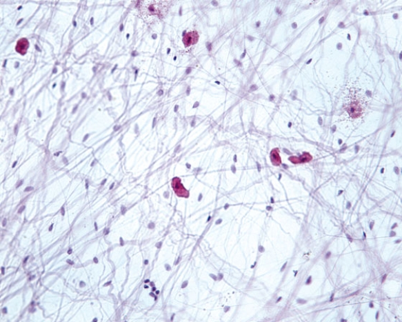 In Fig. Img_012, classify the tissue presented in the accompanying photomicrograph.   A)  dense regular collagenous connective tissue B)  dense irregular collagenous connective tissue C)  loose connective tissue D)  dense regular elastic connective tissue E)  mucoid connective tissue