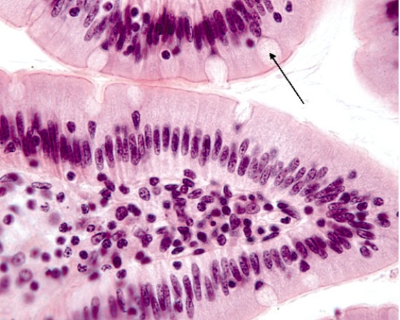 In Fig. Img_005, the cell at the tip of the pointer manufactures and releases   A)  mucinogen B)  mucinase C)  mucus D)  mucilage E)  mucin