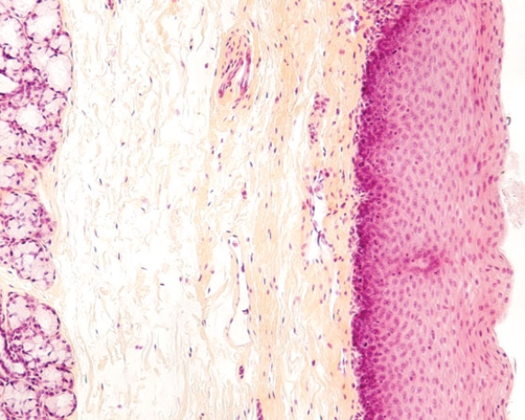 In Fig. Img_018, the epithelium lining the lumen of this organ is classified as   A)  simple squamous B)  simple cuboidal C)  stratified squamous nonkeratinized D)  stratified cuboidal E)  transitional
