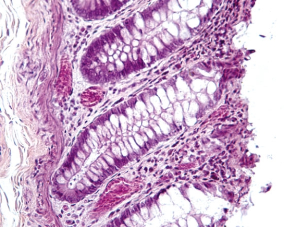 In Fig. Img_021, a large percentage of the epithelial cells of this organ appear to possess an empty region. In life, that region was filled with secretory granules housing   A)  mucus B)  mucinogen C)  mucin D)  trypsinogen E)  trypsin