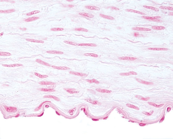 In Fig. Img_023, the epithelium at the free surface is classified as   A)  simple squamous B)  simple cuboidal C)  stratified squamous keratinized D)  stratified cuboidal E)  transitional