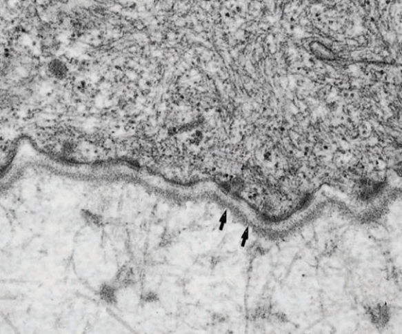 In Fig. Basallamina2, the arrow points to an area that is rich in   A)  type I collagen B)  type II collagen C)  type III collagen D)  type IV collagen E)  type VII collagen