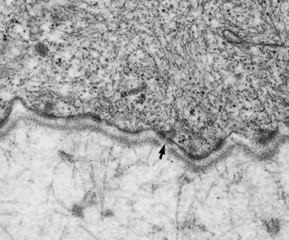 In Fig. Basallamina3, the clear area indicated by the tip of the arrow is rich in   A)  hyaluronic acid B)  fibronectin C)  laminin D)  perlacans E)  cadherins
