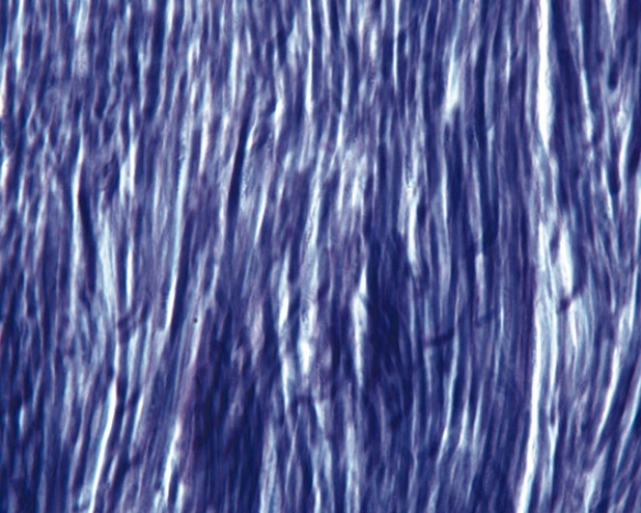 In Fig. Img_016, which of the following familial disorders is due to abnormal development of the tissue represented in the accompanying photomicrograph?   A)  Ehler-Danlos syndrome B)  Marfan syndrome C)  osteogenesis imperfecta D)  Stickler's syndrome E)  benign hypermobility syndrome