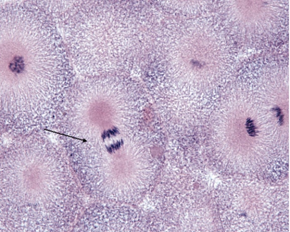 In Fig. Img_009, the cell at the tip of the pointer is in which of the following phases of mitosis?   A)  prophase B)  prometaphase C)  metaphase D)  anaphase E)  telophase