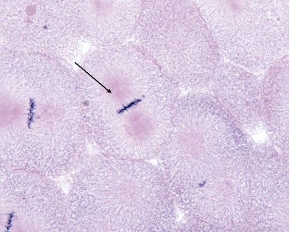 In Fig. Img_010, the cell at the tip of the pointer is in which of the following phases of mitosis?   A)  prophase B)  prometaphase C)  metaphase D)  anaphase E)  telophase