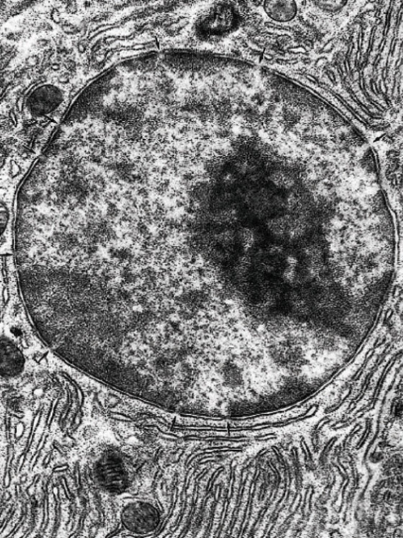 <strong>In the Fig. Nucleus, the cell depicted in this electron micrograph synthesize </strong> A) short-chain lipids B) proteins destined for the cytosol C) cholesterol D) proteins destined to be packaged E) long-chain lipids