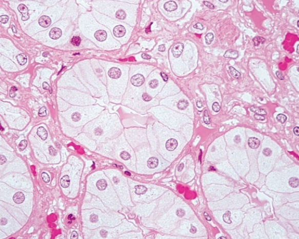 <strong>In Fig. Img_002, the collecting tubule of the kidney, water enters the lumen via </strong> A) pinocytosis B) endocytosis C) aquaporins D) ion channels E) carrier proteins
