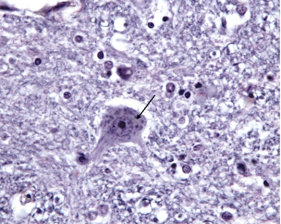 In Fig. Img_004, the structure at the tip of the arrow is responsible for which of the following?   A)  synthesis of ATP B)  assembly of microtubules C)  assembly of neurofilaments D)  synthesis of lysosomal proteins E)  assembly of neurotubules
