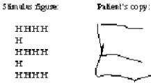 Here are a hierarchical letter figure and a copy of this stimulus drawn by a person with a unilateral brain injury.Where is the most probable location of this injury?   A) The right dorsolateral frontal lobe B) The left temporoparietal cortex C) The right fusiform gyrus D) The left occipital lobe