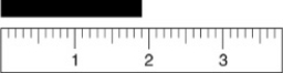 Given the following figure, which of the measurements listed is the best estimate of the length of the aluminum rod?   A)  1.8 cm B)  1.81 cm C)  1.810 cm D)  1.9 cm E)  2 cm