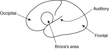 What's wrong with the accompanying diagram?   A)  It fails to show the corpus callosum. B)  It shows Broca's area in the right hemisphere. C)  The labels for the frontal and occipital lobes should be reversed. D)  The auditory area is shown in the wrong lobe of the brain.