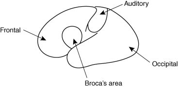 What's wrong with the accompanying diagram?   A)  It fails to show the corpus callosum. B)  It shows Broca's area in the right hemisphere. C)  The labels for the frontal and occipital lobes should be reversed. D)  The auditory area is shown in the wrong lobe of the brain.