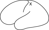 What would most likely be reported if a conscious patient's brain were electrically stimulated at point X on the accompanying diagram?   A)  a tingling on the right side of the body B)  a memory of some past experience C)  some kind of meaningless visual experience D)  hearing some meaningless sounds E)  a strong desire to move the right arm