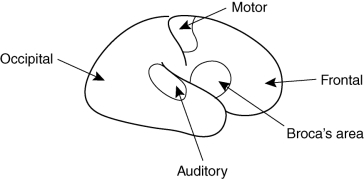 What's wrong with the accompanying diagram of a right-handed person's brain?   A)  It fails to show the corpus callosum. B)  It shows Broca's area in the right hemisphere. C)  The labels for the frontal and occipital lobes should be reversed. D)  The auditory area is shown in the wrong lobe of the brain.