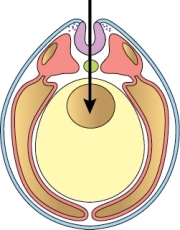 Using the figure of the vertebrate embryo below,list in order the structures that the arrow passes through,starting from the tail of the arrow and ending at its tip.   A)  Epidermal ectoderm,neural tube,endoderm,archenteron B)  Endoderm,ectoderm,notochord,archenteron C)  Neural ectoderm,notochord,gut endoderm,archenteron D)  Neural crest,neural tube,gut endoderm,coelom E)  Epidermal ectoderm,neural tube,mesoderm,coelom