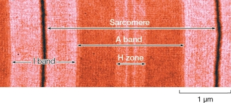 Refer to the figure below.Which statement accurately describes the H zone and I bands of a sarcomere?   A)  The H zone and I bands are regions of the sarcomere that appear light under the microscope because they both represent areas where myosin but not actin filaments are present. B)  The H zone and I bands are the only regions of the sarcomere that do not shorten or lengthen as the sarcomere contracts. C)  A shortening of the H zone is always accompanied by a shortening of the I bands,and a lengthening of the H zone is always accompanied by a lengthening of the I bands. D)  Stimulation by an action potential results in a lengthening of the H zone but a shortening of the I bands. E)  The H zone,but not the I bands,change in width during contraction of the sarcomere.