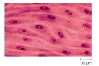 Which type of muscle cell is shown in the image below?   A)  Skeletal B)  Cardiac C)  Smooth D)  Insect flight muscle E)  Both a and d