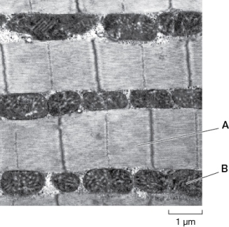 The figure below shows an electron micrograph of a portion of one insect flight muscle cell.Identify the structures labeled A and B.   A)  A = actin and myosin filaments;B = gap junctions B)  A = T tubules;B = sarcoplasm C)  A = actin and myosin filaments;B = mitochondria D)  A = T tubules;B = mitochondria E)  A = sarcoplasm;B = gap junctions