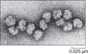 The figure below is an electron micrograph of _______.The picture could have been taken of cellular material from _______.   A)  chloroplasts;a plant but not an animal B)  ribosomes;an animal but not a plant C)  mitochondria;a plant or animal D)  ribosomes;a plant or animal E)  the Golgi apparatus;a plant or animal