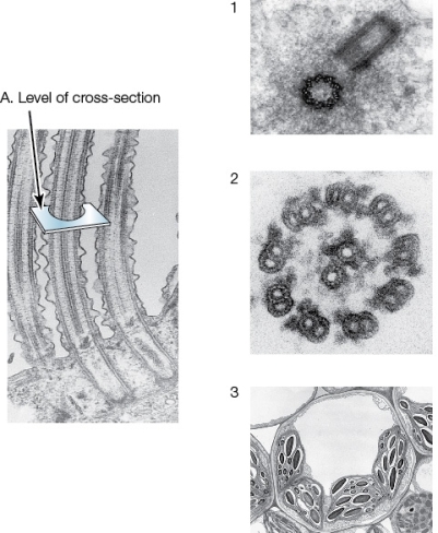 Use the following to answer questions : Refer to the figure below.   -If you took a cross-section of the structure shown on the left at the level labeled  A  and then examined the specimen through electron microscopy,you would most likely see which of the structures shown on the right? A)  1 only B)  2 only C)  3 only D)  1 and 2 only E)  1,2,and 3