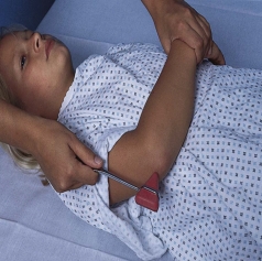 <strong>Which figure depicts a nurse performing a test for the triceps reflex?</strong> A) B) C) D)
