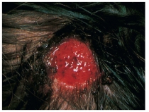 <strong>A school nurse assesses a case of tinea capitis (ringworm)on a 6-year-old child.Which figure depicts the characteristic lesion of tinea capitis?</strong> A) B) C) D)