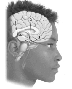 This image depicts three of the key components involved in regulating your internal biological clock. Pick the answer choice that correctly labels the structures in the drawing.   A)  1, suprachiasmatic nucleus. 2, pineal gland. 3, melatonin pathway B)  1, hypothalamus; 2, amygdala; 3, pineal gland C)  1, thalamus; 2, pineal gland; 3, suprachiasmatic nucleus D)  1, pineal gland; 2, suprachiasmatic nucleus; 3, optic nerve