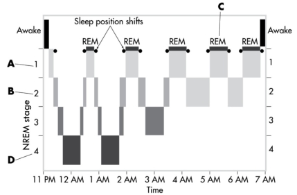 This image depicts the sleep cycles over the course of a typical night. In which stage are night terrors most likely to occur?   A)  stage 1 NREM B)  stage 2 NREM C)  REM sleep D)  stage 4 NREM