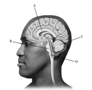 Which letter points to the structure connecting the two cerebral hemispheres?   A)  corpus callosum B)  pons C)  cerebellum D)  medulla