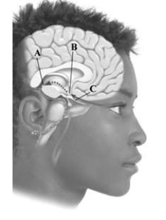 This image depicts key components involved in regulating your internal biological clock. Which structure manufactures melatonin?   A) pineal gland B) suprachiasmatic nucleus C) optic nerve D) None of the answers is correct.