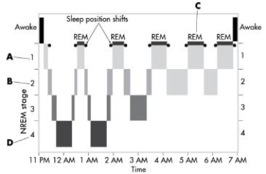   -This image depicts the sleep cycles over the course of a typica lnight. In which stage do delta brain waves exceed 50 percentof total brain activity?  A) stage 1 NREM B) stage 2 NREM C) REM sleep D) stage 4 NREM