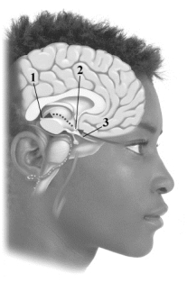 This image depicts three of the key components involved in regulating your internal biological clock. Pick the alternative that correctly labels the structures in the drawing.   A) 1 = pituitary gland, 2 = pineal gland, 3 = melatonin pathway B) 1 = hypothalamus, 2 = optic chiasm, 3 = beta neural pathway C) 1 = thalamus, 2 = circadian center, 3 = bipolar optic pathway D) 1 = pineal gland, 2 = suprachiasmatic nucleus, 3 = optic nerve