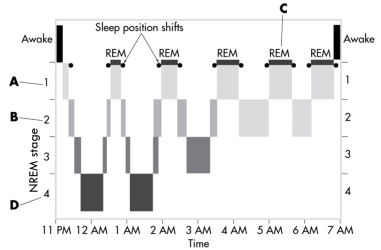 This image depicts the sleep cycles over the course of a typical night. In which stage are hypnagogic hallucinations most likely to occur?   A) stage 1 NREM B) stage 2 NREM C) REM sleep D) stage 4 NREM