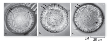Figure 17.21   -In Figure 17.21,the authors show pictures of the modern diatoms S.niagarae (a) and S.yellowstonensis (c) as well as a transitional fossil.Which modern species does the transitional fossil most resemble? A) S. yellowstonensis B) S. niagarae BLOOM'S LEVEL: 4. Analyze LEARNING OUTCOME: 12.04.01 Compare and contrast homologous, analogous, and vestigial structures.LEARNING OUTCOME: 17.02.01 Describe the characteristics of euglenoid and dinoflagellate protists.SECTION: 12.04 SECTION: 17.06 TOPIC: Evolution-Speciation TOPIC: Investigating Life TOPIC: Protists