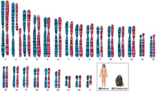 Chromosome 2 in Homo sapiens formed when two smaller chromosomes fused,after the chimpanzee and human lineages split.As a result,humans have 23 pairs of chromosomes and chimpanzees have 24 and can no longer form fertile offspring (Fig.14.31) .This would allow humans and chimps to evolve independently while living in the same location also known as:   A) Gradualism B) Allopatric speciation C) Parapatric speciation D) Natural selection E) Sympatric speciation