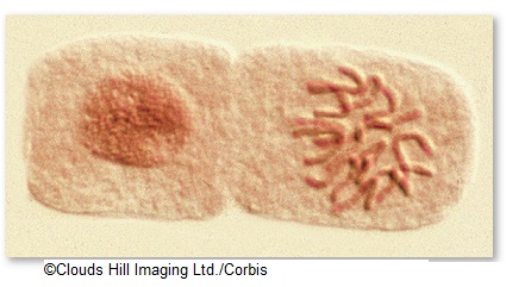 <strong>In a biology lab exercise,you are asked to examine cells of a growing onion root tip,that has been sectioned to show many cells.In most of the cells,you easily see the circular or oval nucleus as a uniformly filled space in a membrane outline.In a small percentage of cells,you see chromosomes as distinct strands just as cell division begins,and as it progresses,because the chromatin </strong> A) becomes more tightly folded, increasing their visible length. B) becomes less tightly folded, increasing their visible length. C) becomes less tightly wound, to facilitate cell division. D) becomes more tightly wound, to protect DNA, and to more easily manage cell division. E) increases in length, as replication adds DNA sections to the original.